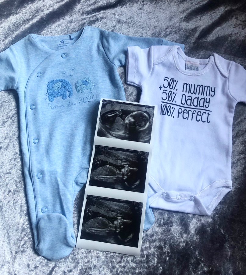 20 week baby scan