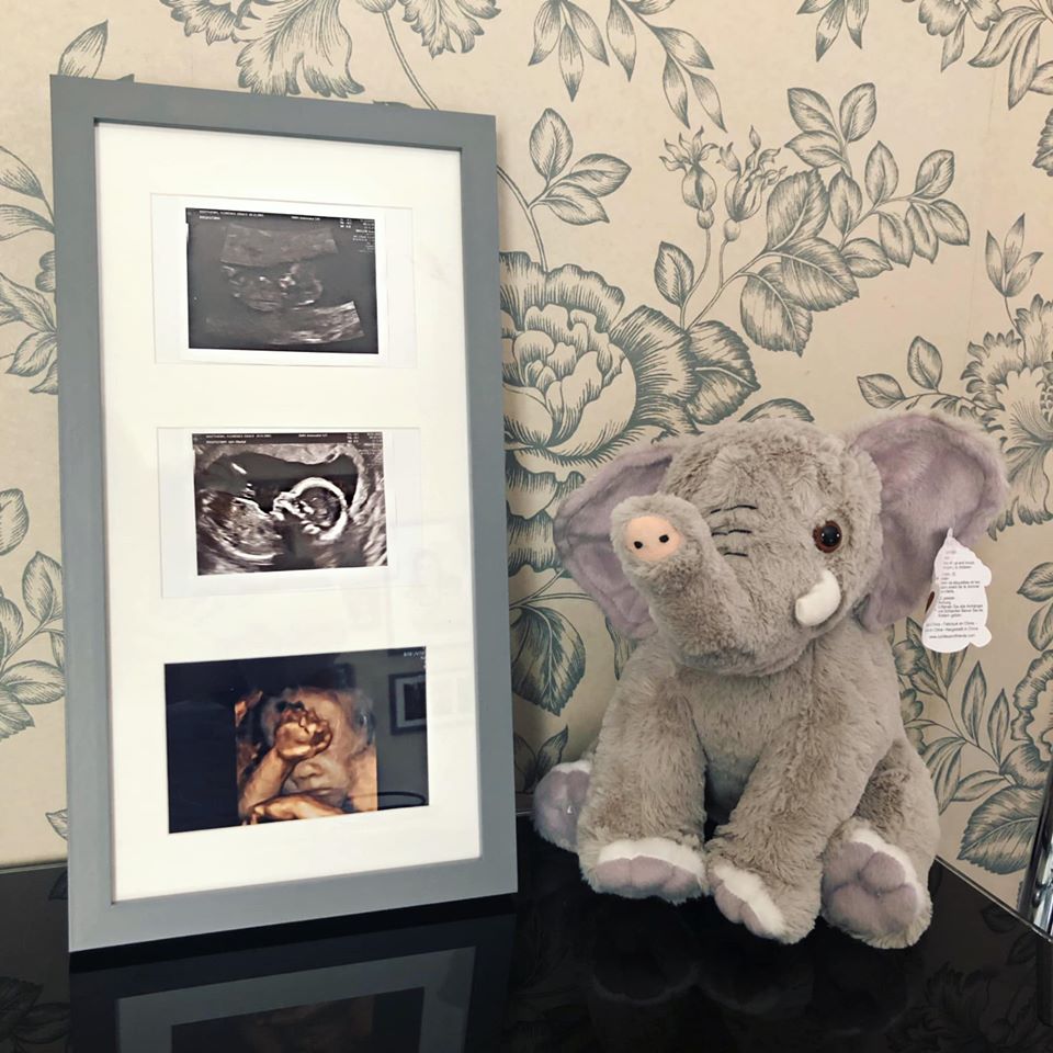 baby scan