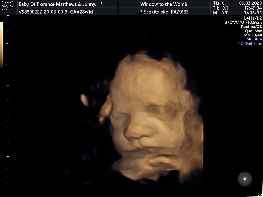 4D baby scan 28 weeks